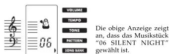 CASIO SA-75 - Hören eines Songbank-Musikstück - 2