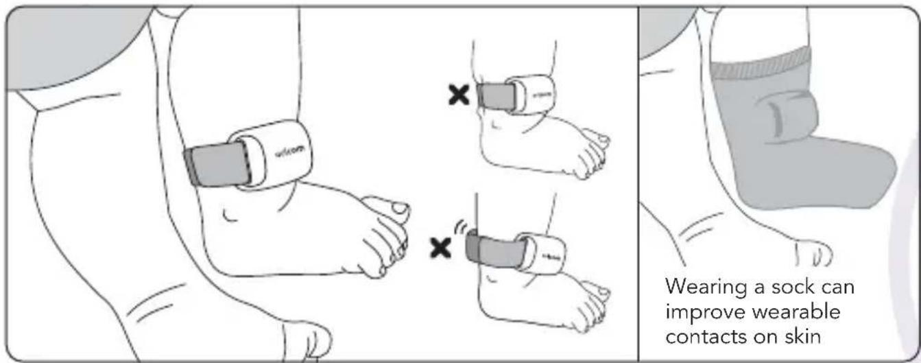 Wearing a sock can improve wearable contacts on skin