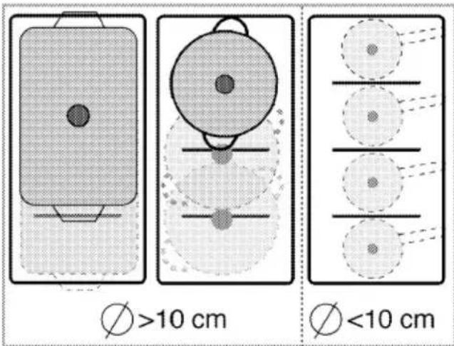 Ø>10 cm Ø<10 cm
