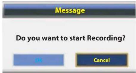 Message Do you want to start Recording? OK Cancel