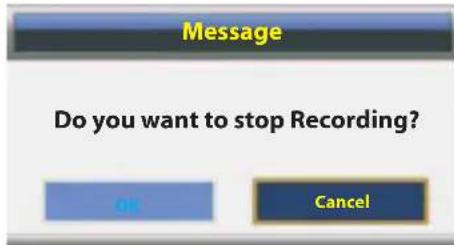 Message Do you want to stop Recording? OK Cancel