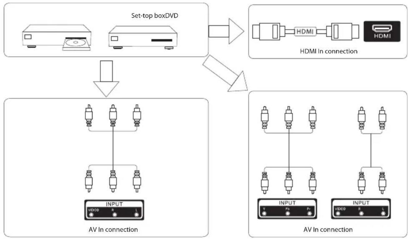 ECG 32 731 PVR - Interface - 12