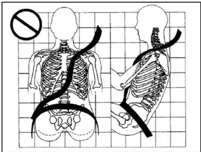 Medical illustration showing human skeletal anatomy with a no-smoking symbol, including left and right views of the spine and torso.