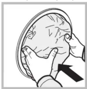 Illustration of hands performing a medical procedure on a patient's head (no text or symbols present)