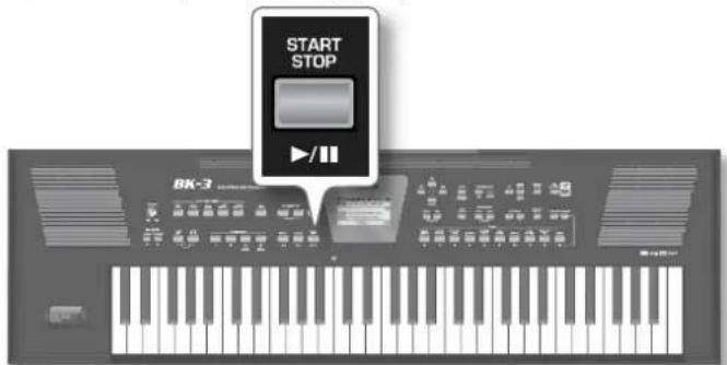 START STOP BK-3