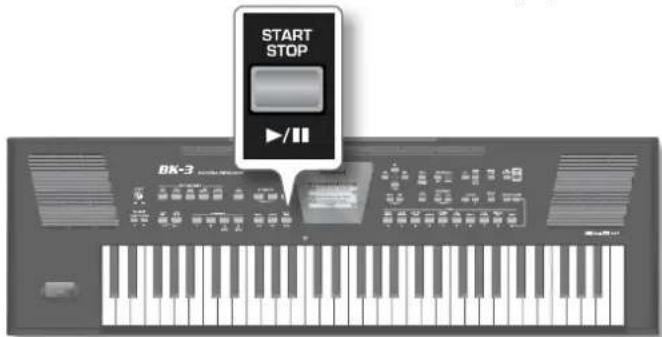 START STOP BK-3