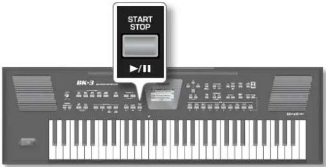 START STOP BK-3
