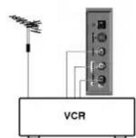 VCR