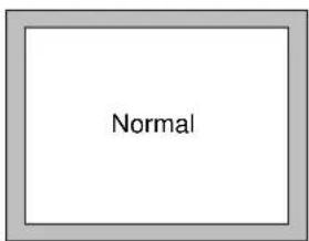 Normal