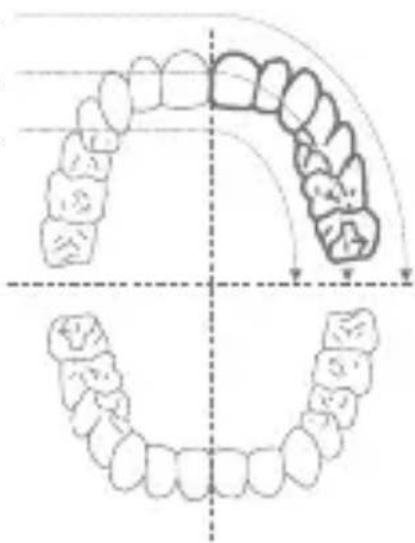 Diagram illustrating dental arch and jaw structure with labeled components and alignment markers