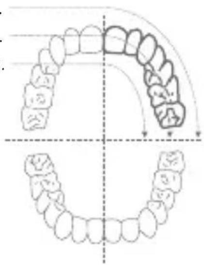 Diagram illustrating dental arch and jaw structure with labeled components and directional arrows