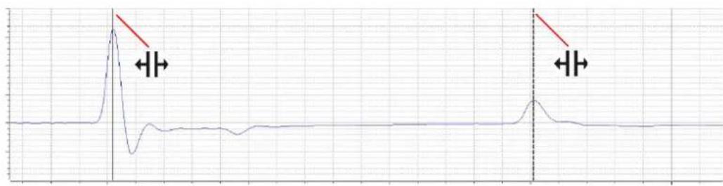 | Time Segment | Value | | ------------ | ----- | | Peak 1 | High | | Peak 2 | Low |