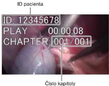 ID pacienta ID: 12345678 PLAY 00:00:08 CHAPTER: 001/001 Číslo kapitoly
