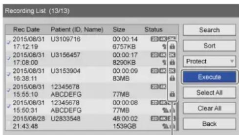 Recording List (13/13) Rec Date Patient (ID, Name) Size Status 2015/08/31 U3109716 00:00:14 2000 17:12.19 6757KB 2015/08/31 U3156457 00:00:17 2000 17:08:00 8290KB 2015/08/31 U3153904 00:00:09 2000 16:38.11 83MB 2015/08/31 12345678 2000 15:55.10 ABCDEFG 77MB 2015/08/31 12345678 00:00:08 2000 15:50.31 ABCDEFG 77MB 2015/08/28 U2833548 48:00:02 2000 21:43.48 1539GB Search Sort Protect Execute Select All Clear All Back