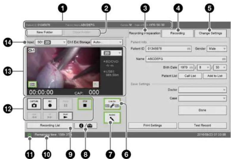 1 2 3 4 5 New Folder Close Folder 14 Input SDI 2D Ch1 Ext Storage Auto... 13 Ch1 00:00:00 CAP: 000 12 CAPTURE REC FTP USB1: 96h 88m 11 Recording List 10 Remaining time: 156h 37 9 Audio 7 7 6 Recording preparation Recording Change Settings Patient Info. Patient ID 01345678 Gender Male Name: ABCDEFG Birth Date 1970 ns / 8 / 30 Patient List Call List Add to List Save Settings Doctor Case Done Print Settings Test Record 2016/08/23 07:33:08