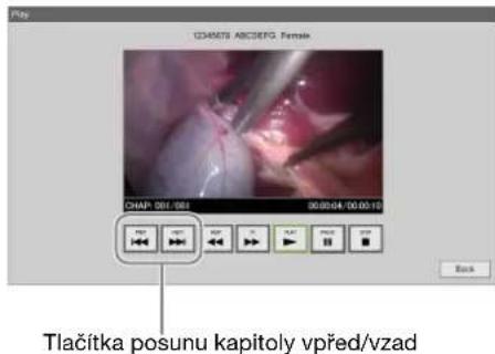 CDASCTS ABCDEFG Female CHAP: 001.001 00:00:04:00:00:10 Back Tlačitka posunu kapitoly vpřed/vzad