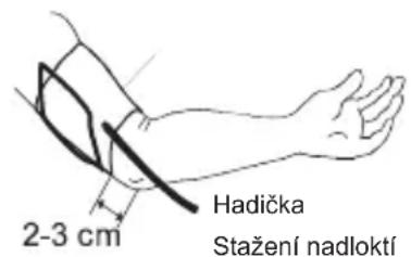 Meriden Xlive3 - UPEVNĚNÍ MANŽETY NA PAŽI - 2
