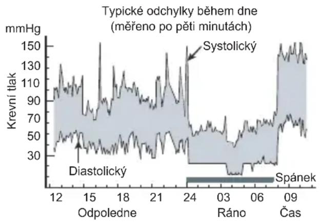 Meriden Xlive3 - Odchylky krevního tlaku - 2