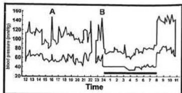 CITIZEN CH-606 - Variations in blood pressure - 1