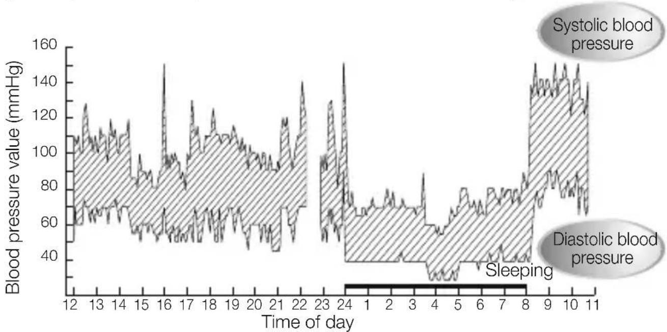 CITIZEN CH-657 - Your blood pressure changes all the time. - 1