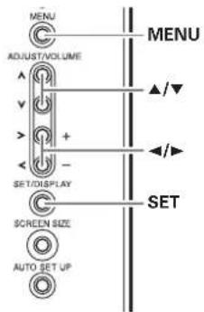 MENU ADJUST/VOLUME ▲/▼ SET/DISPLAY SCREEN SIZE AUTO SET UP MENU SET