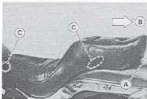 Medical diagram showing labeled anatomical or pathological features with annotations A, B, and C