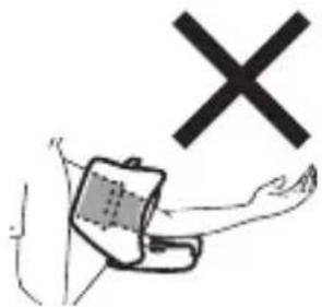 Diagram showing a hand holding a device with a large 'X' symbol above it, indicating a medical or diagnostic mark.