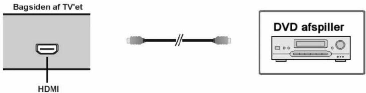 Amitech 25318 - Tilslutning via HDMI - 1