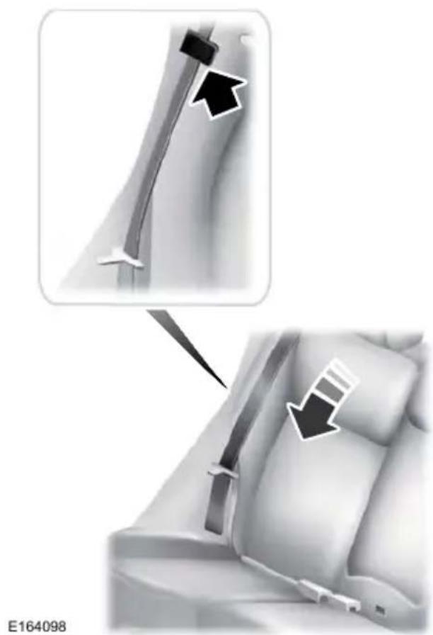 Medical illustration showing a surgical procedure on a patient's arm, with arrows indicating direction of movement (no text or symbols present)