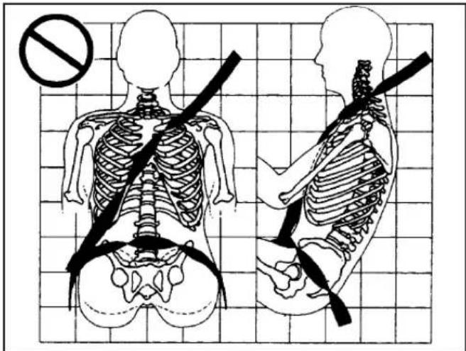 Medical illustration showing human skeletal anatomy with a no-smoking symbol, including a cross-section of the lower torso and a side view of the upper torso.
