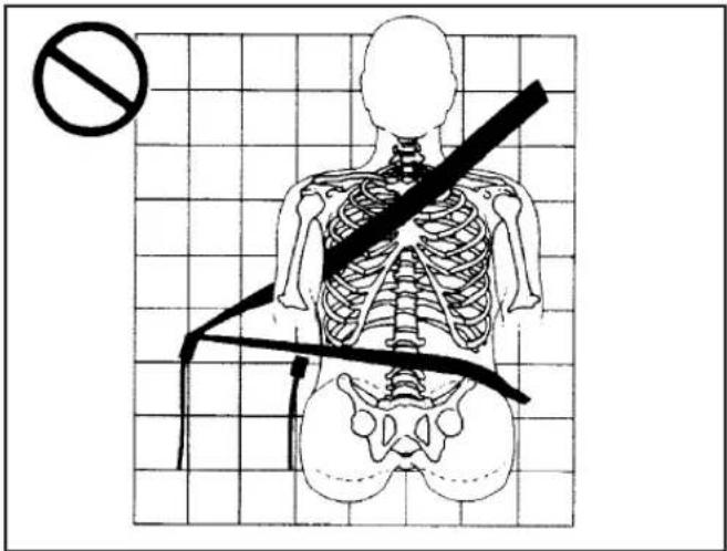 Safety warning sign with pictogram of human skeleton and a diagonal band, no text present