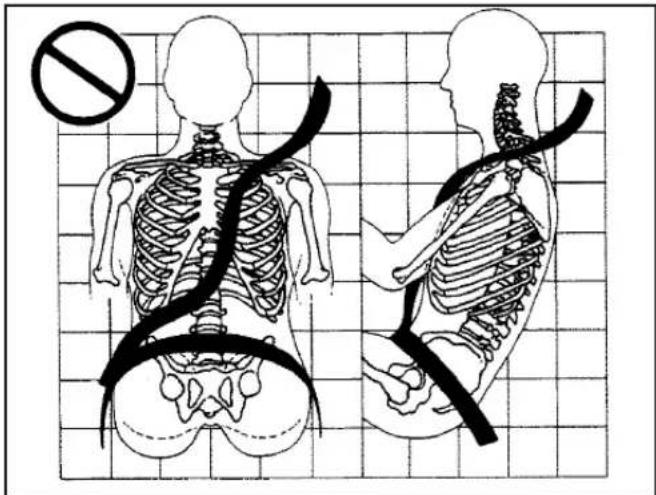 Medical illustration showing human skeletal anatomy with a no-smoking symbol and corresponding side-view illustrations.