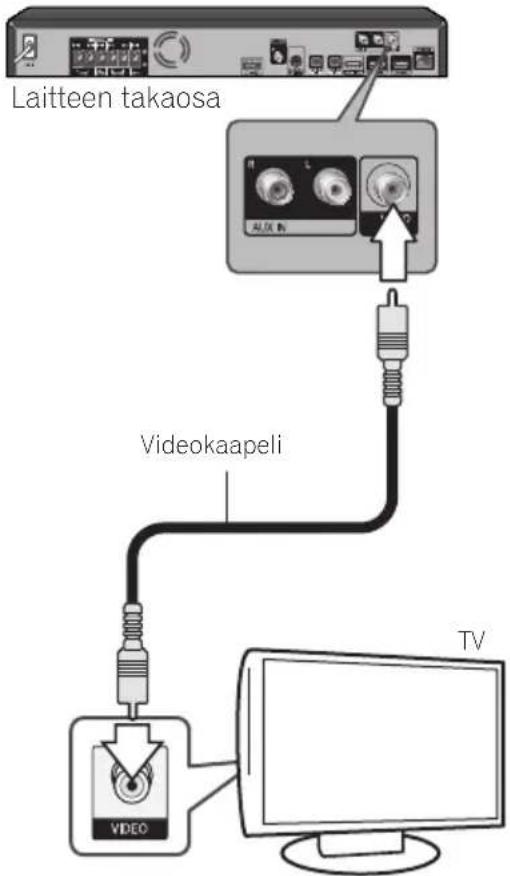 Laitteen takaosa Videokaapeli TV
