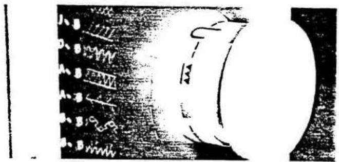 Cropped image showing fragmented text and symbols, possibly from a document or form with visible characters and numbers.