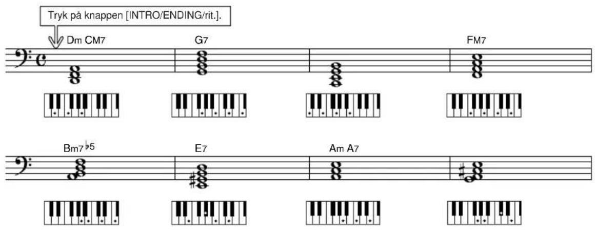 YAMAHA YPG-635 - Bossa Nova - 1