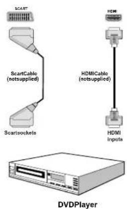 SCART ScartCable (notsupplied) Scartsockets HDMI HDMI Cable (notsupplied) HDMI Inputs DVDPlayer
