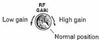 Low gain RF GAIN High gain Normal position