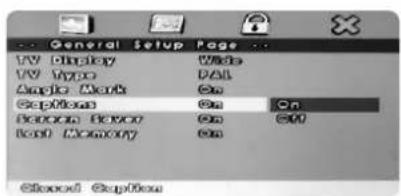 General Setup Page UV Display Wide UV Type PAL Angle Work On Options On Button Button On Load Memory On Closed Options