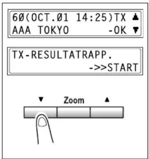 60(OCT.01 14:25)TX AAA TOKYO -OK TX-RESULTATRAPP. ->>START Zoom