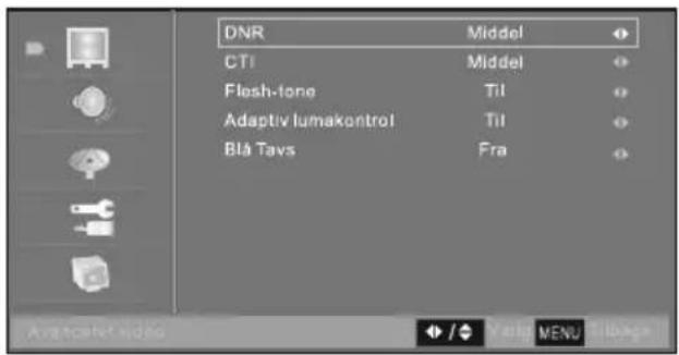 Prosonic X19/69D-GB-HCU-DK - Sådan justeres Dynamic Noise Reduction (dynamisk støjreduktion) - 1
