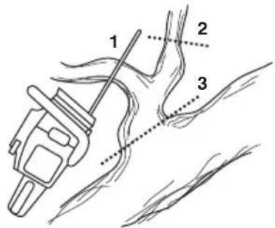 JONSERED CS 2258 - Kvistning - 1