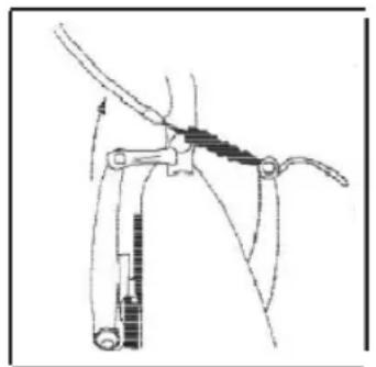 Devron Sidney 28324 - Udskift bremseklodser - 1