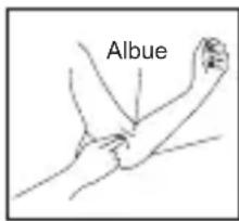 Albue