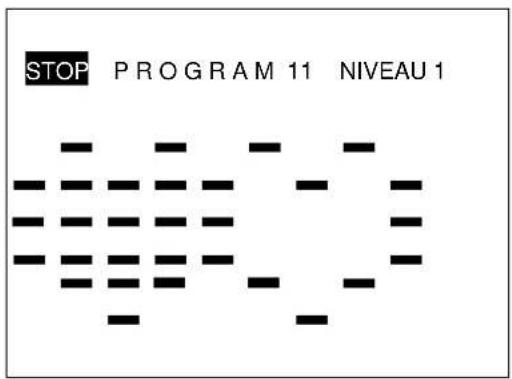 STOP PROGRAM 11 NIVEAU 1