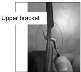 Upper bracket