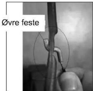 Øvre feste