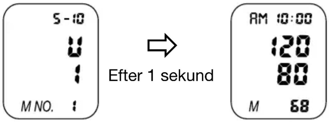 5 - 10 M NO. : Efter 1 sekund AM 10:00 120 80 M 68