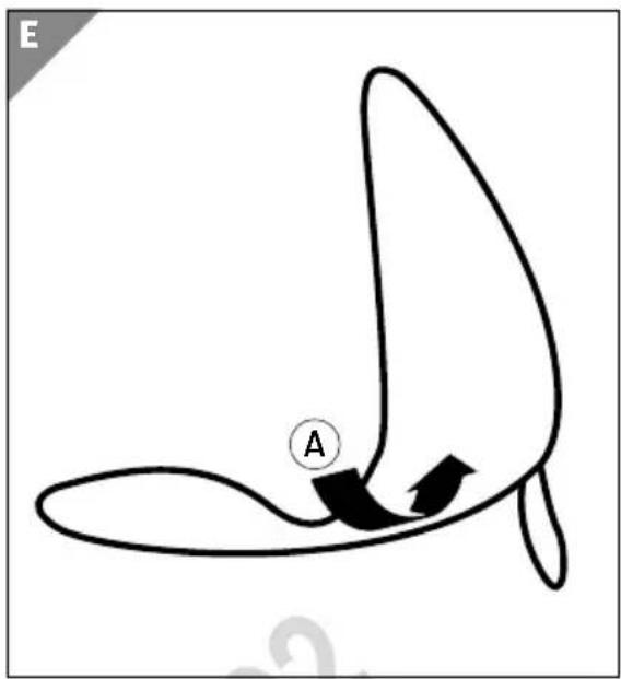 Simple line drawing of a curved shape with an arrow and labeled point A, no text or symbols present.