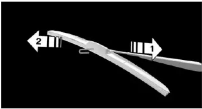 Diagram of a medical or surgical tool with two labeled arrows (2 and 1) pointing to a curved tool or device, against a black background (no text or symbols on the diagram itself)