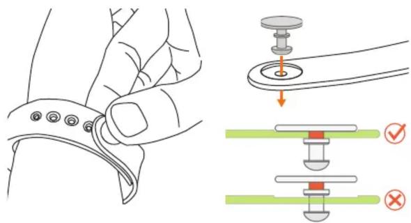 Medical illustration showing a hand adjusting a screwdriver with a magnified view of the screw being held, accompanied by check and cross symbols.